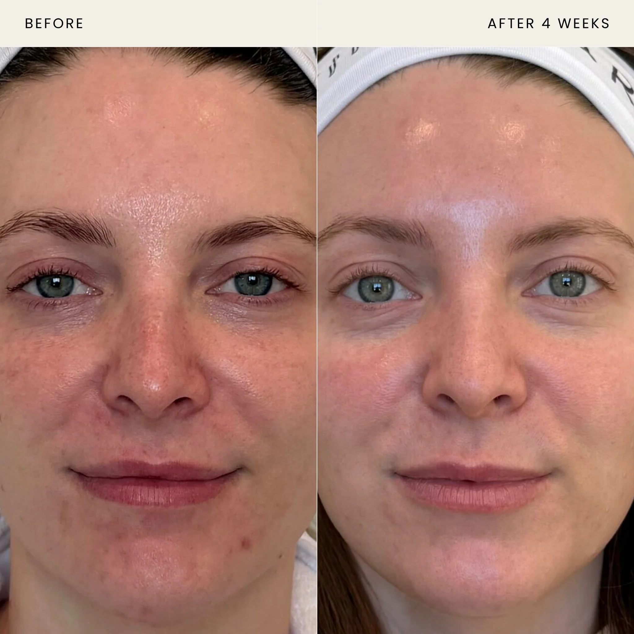 Daily Peptide Duo - Image 4
