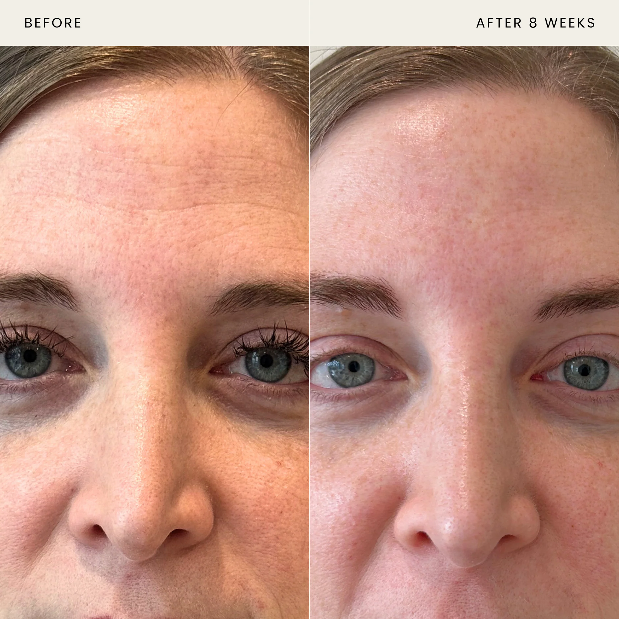 Youth Serum - Image 3